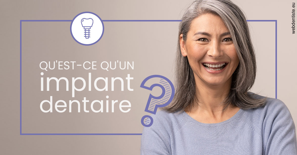 https://selarl-dr-jean-jacques-roux.chirurgiens-dentistes.fr/Implant dentaire 1