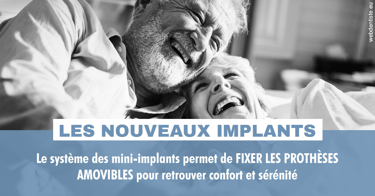 https://selarl-dr-jean-jacques-roux.chirurgiens-dentistes.fr/Les nouveaux implants 2
