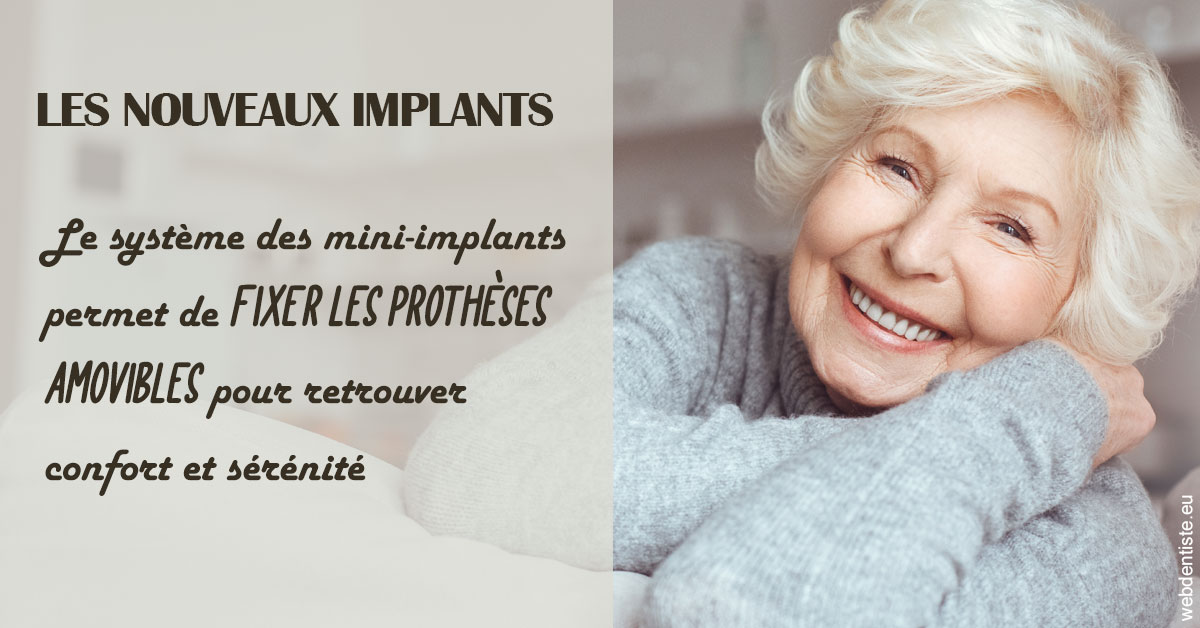 https://selarl-dr-jean-jacques-roux.chirurgiens-dentistes.fr/Les nouveaux implants 1