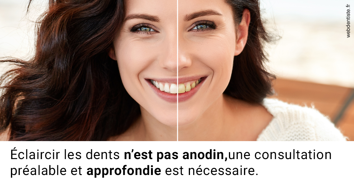 https://selarl-dr-jean-jacques-roux.chirurgiens-dentistes.fr/Le blanchiment 2