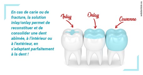 https://selarl-dr-jean-jacques-roux.chirurgiens-dentistes.fr/L'INLAY ou l'ONLAY