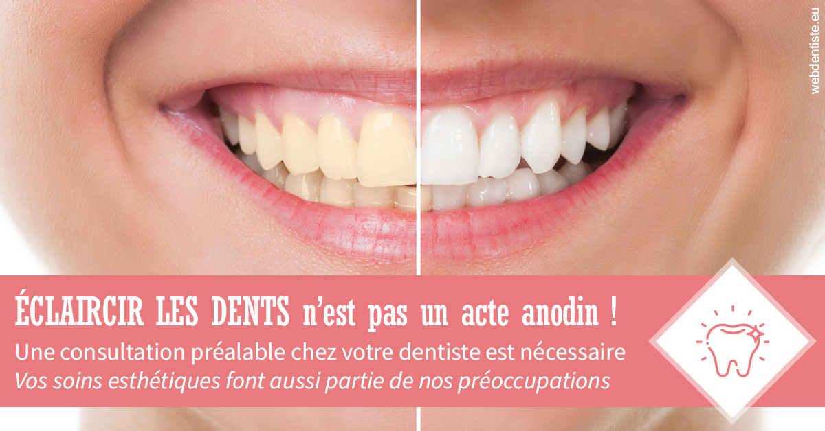 https://selarl-dr-jean-jacques-roux.chirurgiens-dentistes.fr/Eclaircir les dents 1