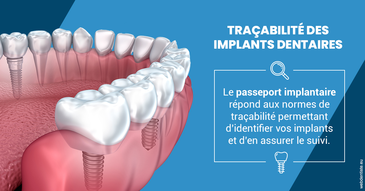 https://selarl-dr-jean-jacques-roux.chirurgiens-dentistes.fr/T2 2023 - Traçabilité des implants 1