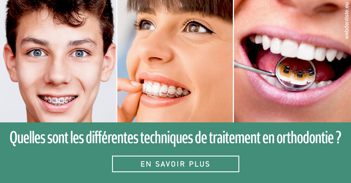 https://selarl-dr-jean-jacques-roux.chirurgiens-dentistes.fr/Les différentes techniques de traitement 2