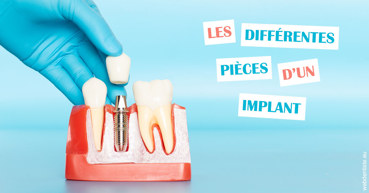 https://selarl-dr-jean-jacques-roux.chirurgiens-dentistes.fr/Les différentes pièces d’un implant 2