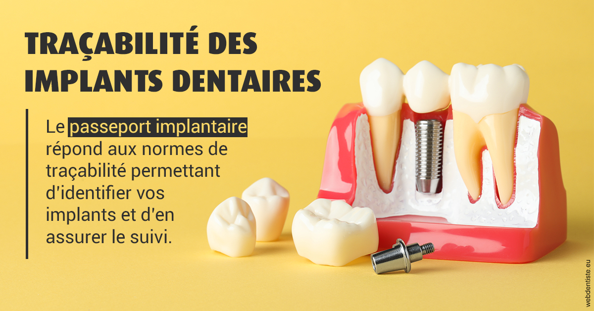https://selarl-dr-jean-jacques-roux.chirurgiens-dentistes.fr/T2 2023 - Traçabilité des implants 2