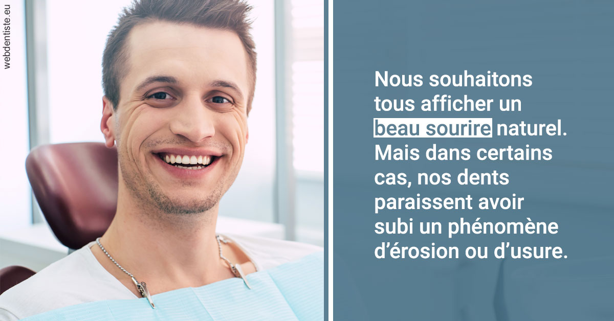 https://selarl-dr-jean-jacques-roux.chirurgiens-dentistes.fr/Érosion et usure dentaire