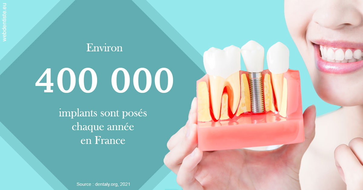 https://selarl-dr-jean-jacques-roux.chirurgiens-dentistes.fr/Pose d'implants en France 2