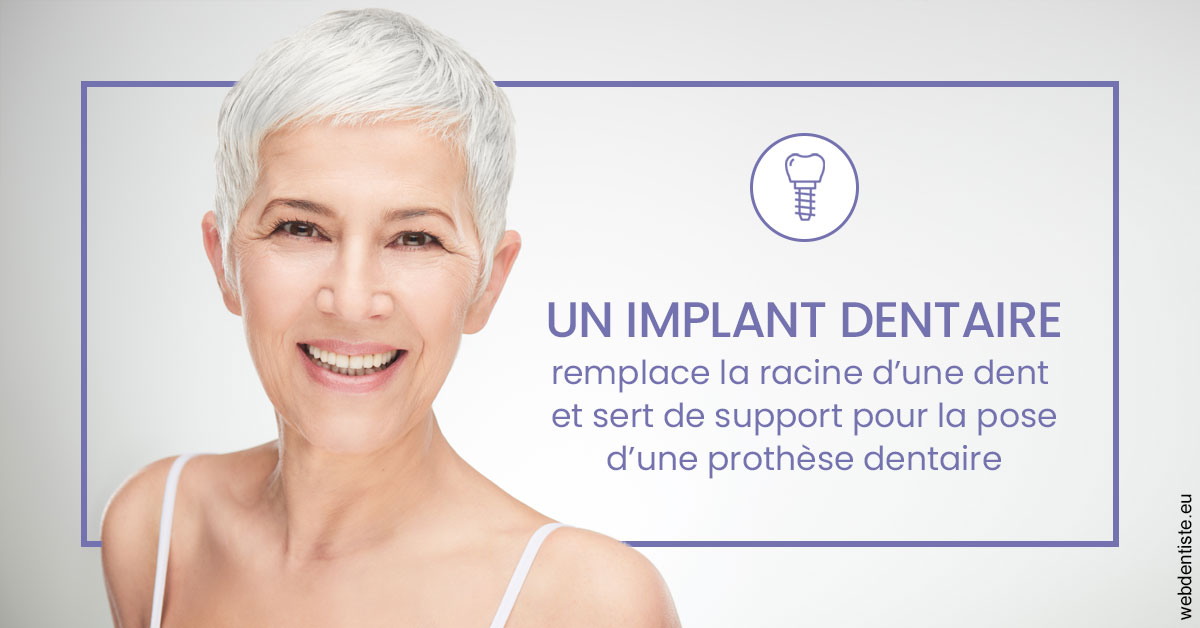https://selarl-dr-jean-jacques-roux.chirurgiens-dentistes.fr/Implant dentaire 1
