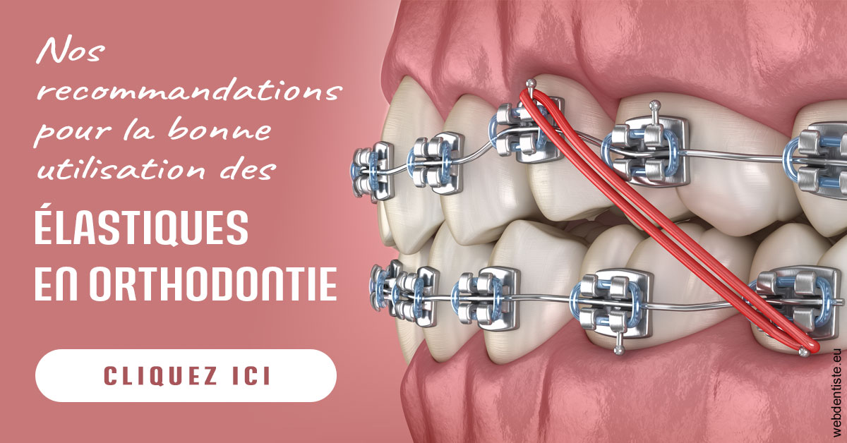 https://selarl-dr-jean-jacques-roux.chirurgiens-dentistes.fr/Elastiques orthodontie 2